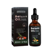 Only Supports Self Pickup With Waybill Amococo Batana Oil With Rosemary Cold Pressed Natural Hair Growth Oil, Nourishes Scalp, Repairs Damaged Hair, Reduces Split Ends, Boosts Hair Thickness &